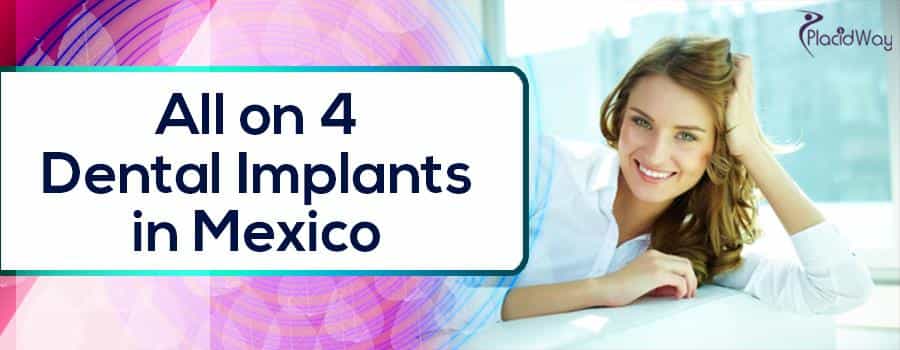 Getting an All on Four Dental Implant in Mexico